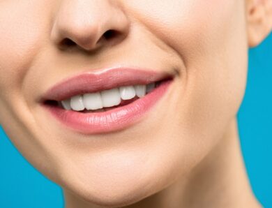 Remoção de preenchimento labial: entenda o procedimento realizado por Gkay